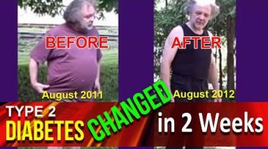 Lose 50 lbs – How CBD Oil Changed Type-2 Diabetes In 2 Weeks! – CBDOilStudy.org/Free-Samples