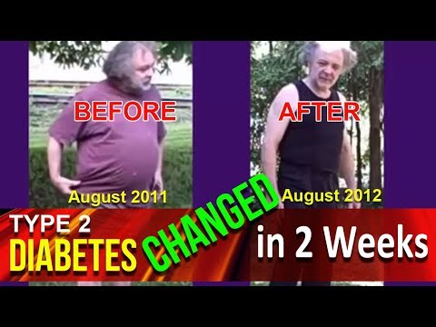 Lose 50 lbs – How CBD Oil Changed Type-2 Diabetes In 2 Weeks! – CBDOilStudy.org/Free-Samples