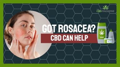 Buy CBD for rosacea
