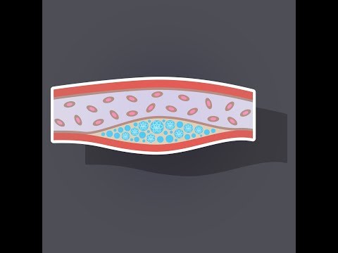 CBD FOR ATHEROSCLEROSIS | What Is CBD?