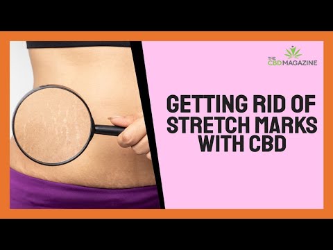 Can CBD be used to treat stretch marks? – Useful CBD skin care benefits!