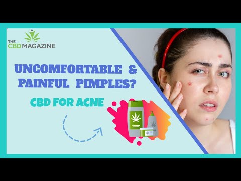Combating pimples with CBD – Easy suggestions to make use of CBD oil for pimples?