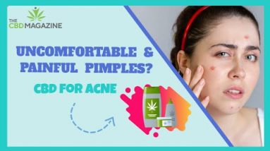 CBD for Acne | How to Receive Rid Of Acne?