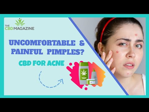 CBD for Acne | How to Receive Rid Of Acne?