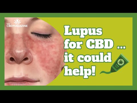 CBD cream for lupus – Can CBD oil assist with itchy pores and skin?