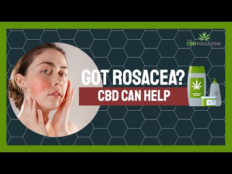 Be taught about CBD and dry pores and skin | Basically the most intriguing CBD cream for rosacea